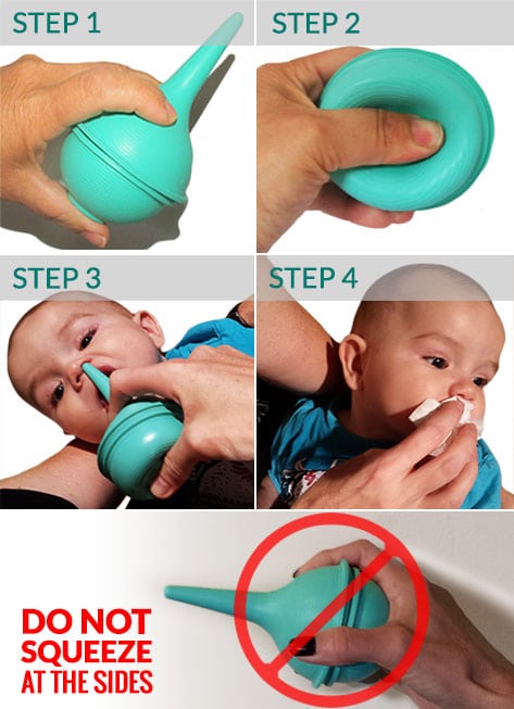 using nasal aspirator for babies